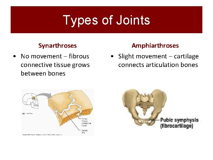 Types of Joints Synarthroses • No movement – fibrous connective tissue grows between bones