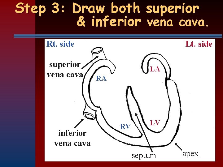 Step 3: Draw both superior & inferior vena cava. Rt. side superior vena cava