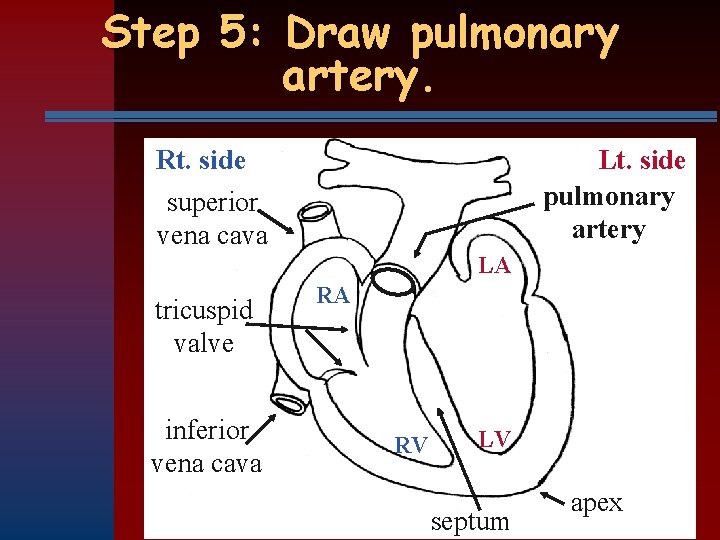 Step 5: Draw pulmonary artery. Rt. side superior vena cava Lt. side pulmonary artery