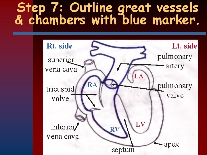 Step 7: Outline great vessels & chambers with blue marker. Rt. side Lt. side