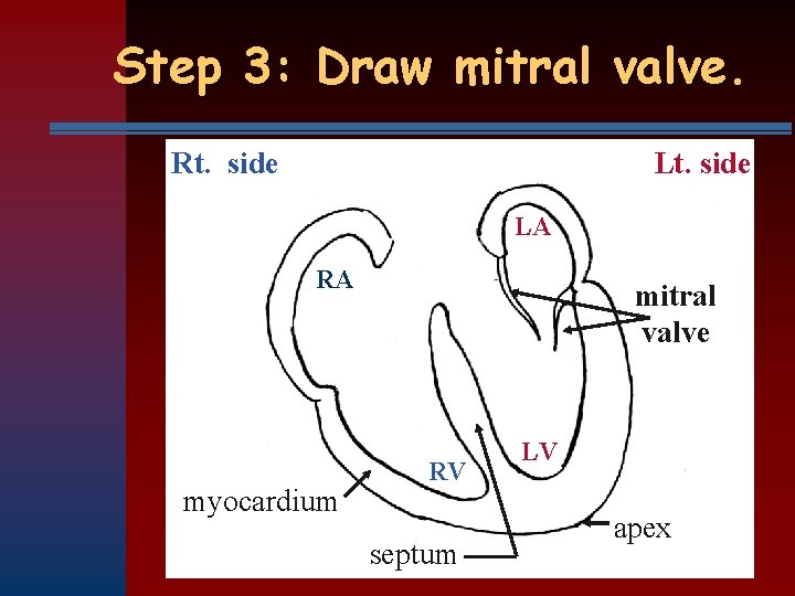 Step 3: Draw mitral valve. Rt. side LA RA myocardium mitral valve RV septum