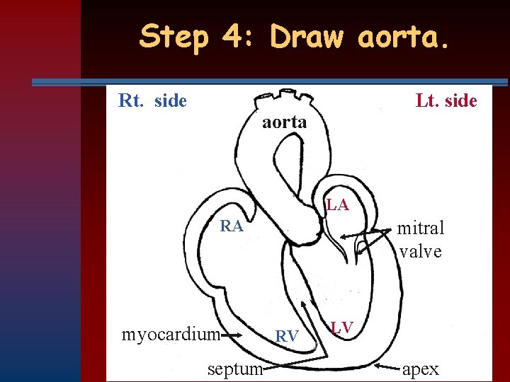 Step 4: Draw aorta. Rt. side Lt. side aorta LA RA myocardium septum mitral