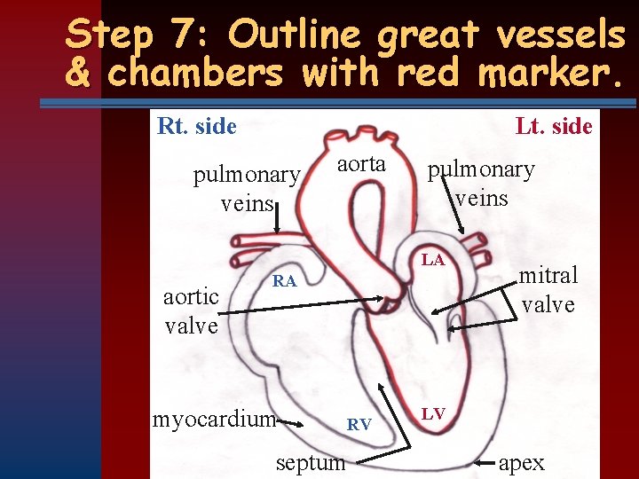 Step 7: Outline great vessels & chambers with red marker. Rt. side Lt. side