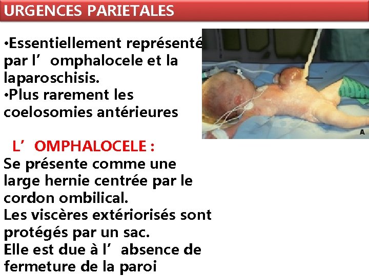 URGENCES PARIETALES • Essentiellement représentées par l’omphalocele et la laparoschisis. • Plus rarement les