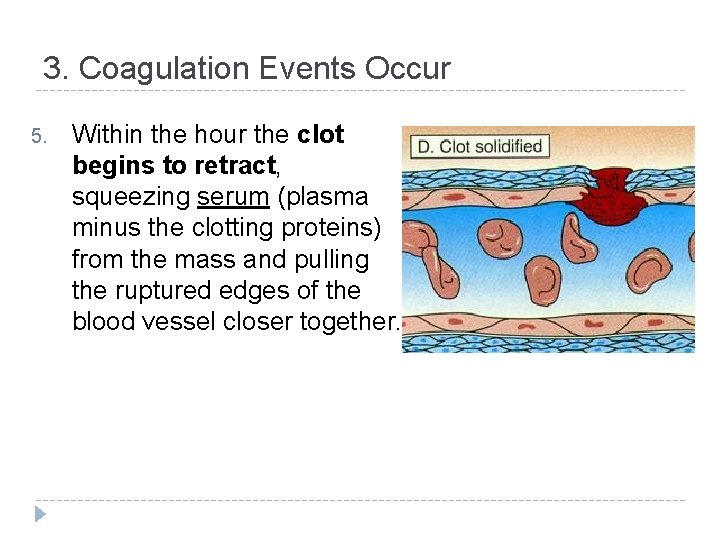 3. Coagulation Events Occur 5. Within the hour the clot begins to retract, squeezing