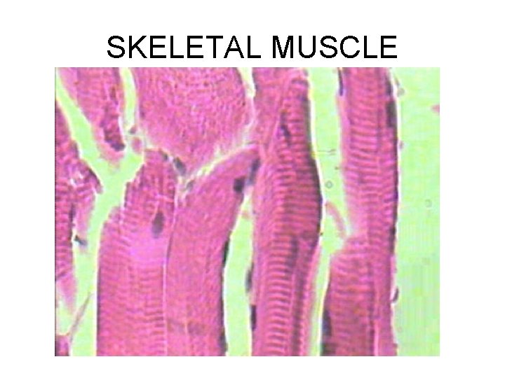 SKELETAL MUSCLE 