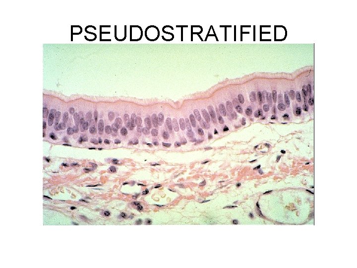 PSEUDOSTRATIFIED 