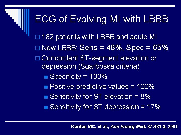 ECG of Evolving MI with LBBB o 182 patients with LBBB and acute MI