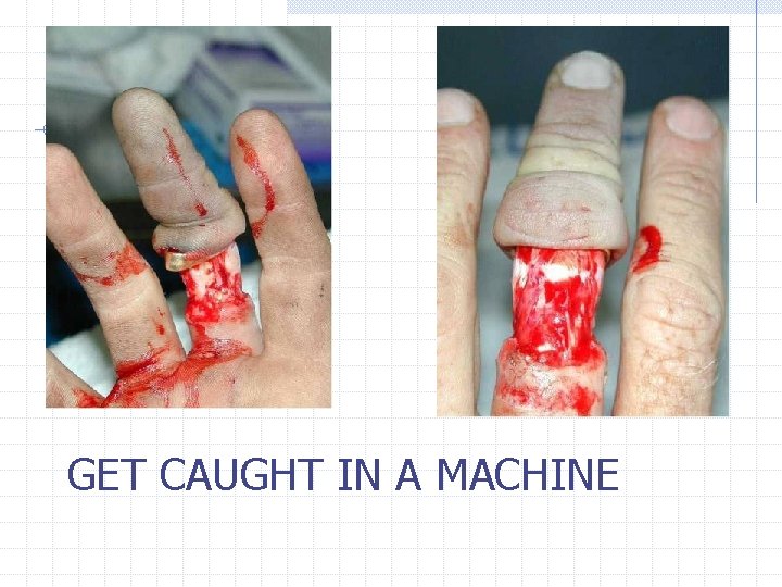 GET CAUGHT IN A MACHINE 