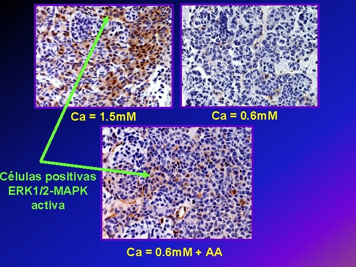 Ca = 1. 5 m. M Ca = 0. 6 m. M Células positivas