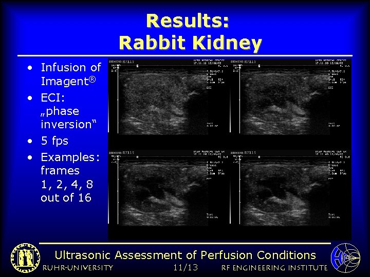 Results: Rabbit Kidney • Infusion of Imagent® • ECI: „phase inversion“ • 5 fps