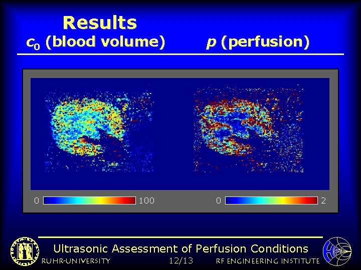 Results c 0 (blood volume) 0 p (perfusion) 100 0 Ultrasonic Assessment of Perfusion