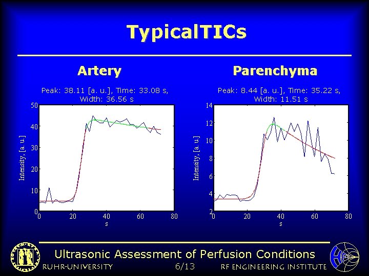 Typical. TICs Artery 50 Parenchyma Peak: 38. 11 [a. u. ], Time: 33. 08