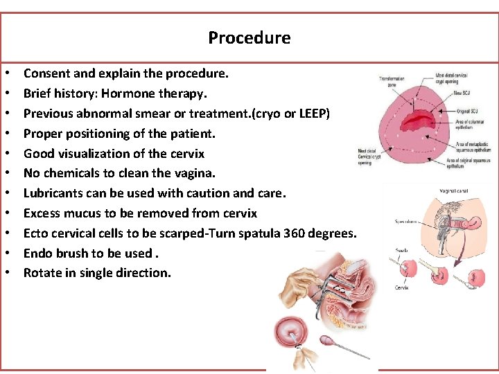 Procedure • • • Consent and explain the procedure. Brief history: Hormone therapy. Previous