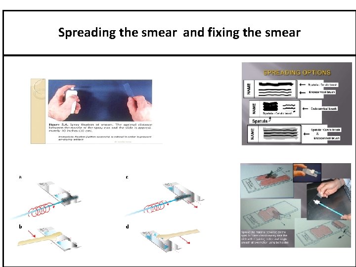 Spreading the smear and fixing the smear 