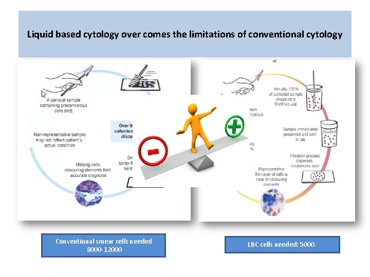 Liquid based cytology over comes the limitations of conventional cytology Conventional smear cells needed