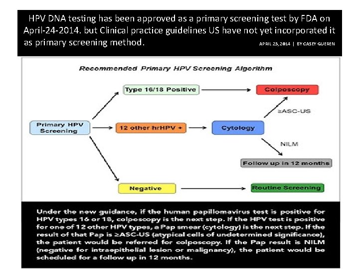 HPV DNA testing has been approved as a primary screening test by FDA on
