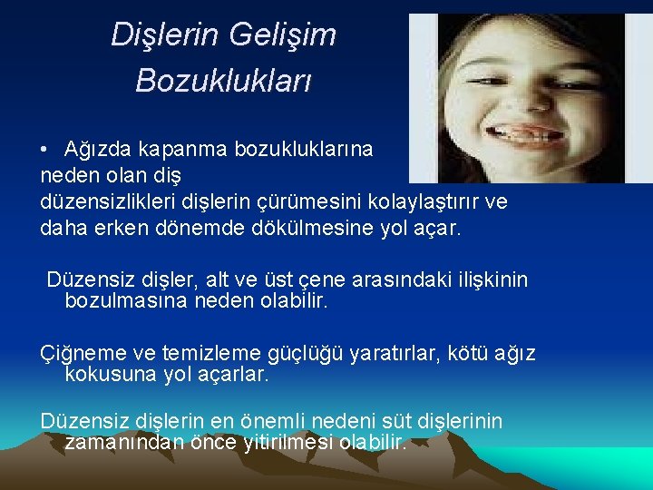 Dişlerin Gelişim Bozuklukları • Ağızda kapanma bozukluklarına neden olan diş düzensizlikleri dişlerin çürümesini kolaylaştırır