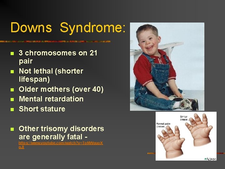 Downs Syndrome: n n n 3 chromosomes on 21 pair Not lethal (shorter lifespan)