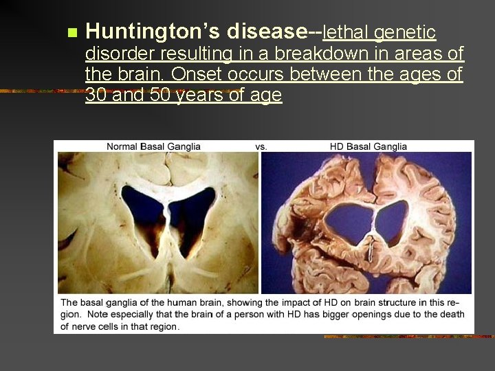 n Huntington’s disease--lethal genetic disorder resulting in a breakdown in areas of the brain.