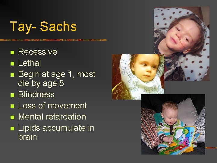 Tay- Sachs n n n n Recessive Lethal Begin at age 1, most die