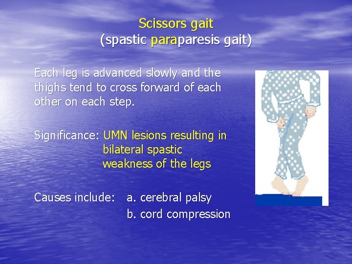 Scissors gait (spastic paraparesis gait) Each leg is advanced slowly and the thighs tend