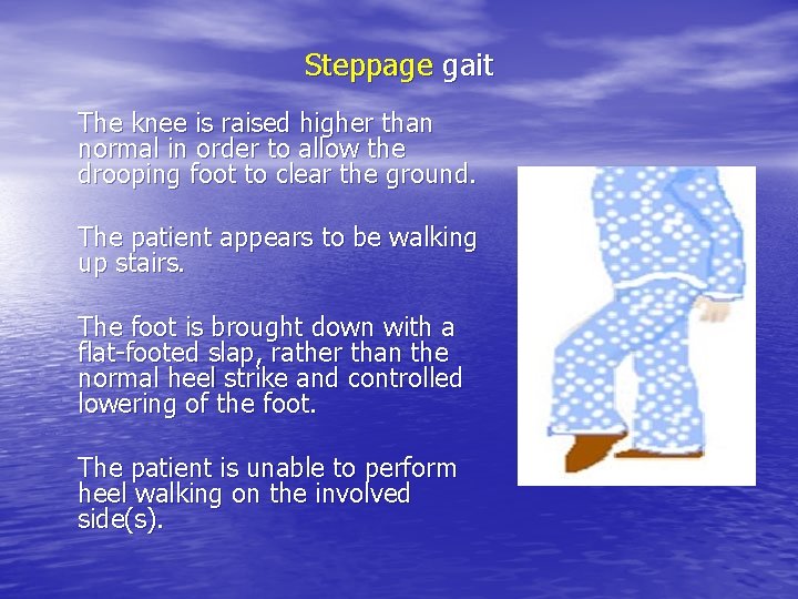 Steppage gait The knee is raised higher than normal in order to allow the