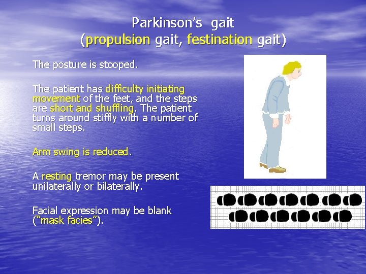 Parkinson’s gait (propulsion gait, festination gait) The posture is stooped. The patient has difficulty