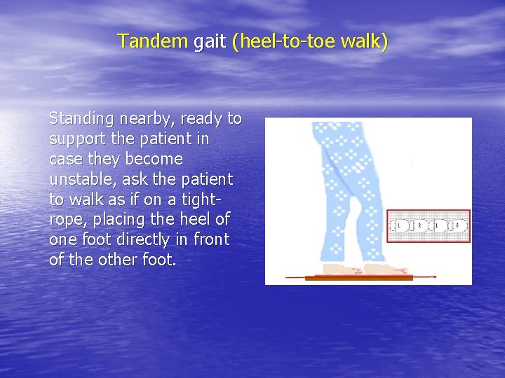 Tandem gait (heel-to-toe walk) Standing nearby, ready to support the patient in case they