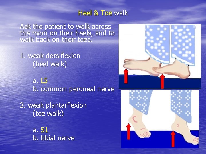 Heel & Toe walk Ask the patient to walk across the room on their Heel & Toe walk Ask the patient to walk across the room on their