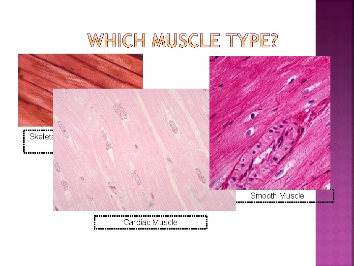 Skeletal muscle with obvious striations Smooth Muscle Cardiac Muscle 