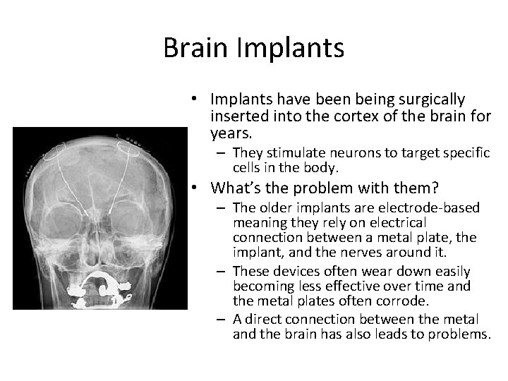 Brain Implants • Implants have been being surgically inserted into the cortex of the