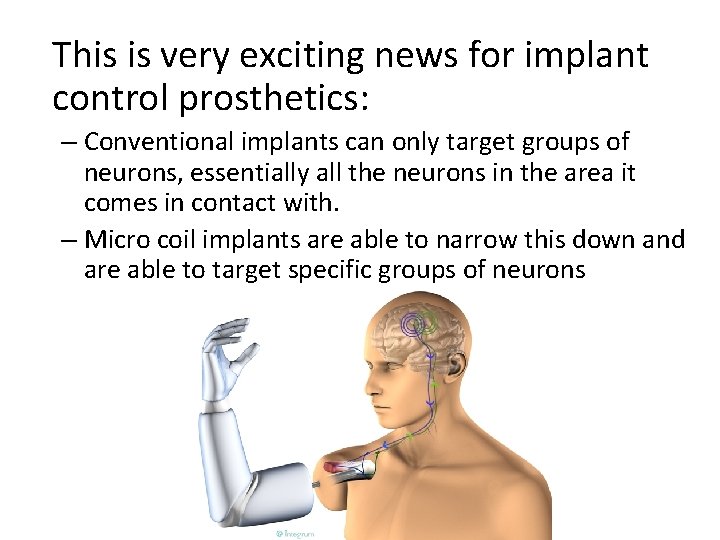 This is very exciting news for implant control prosthetics: – Conventional implants can only