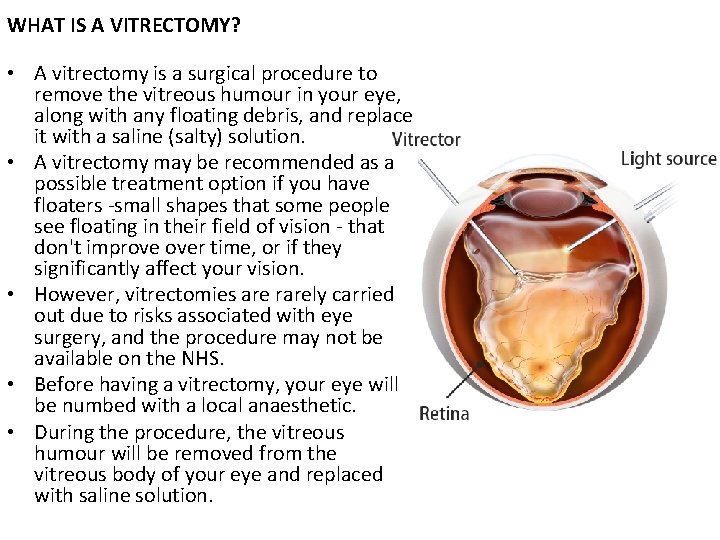 WHAT IS A VITRECTOMY? • A vitrectomy is a surgical procedure to remove the
