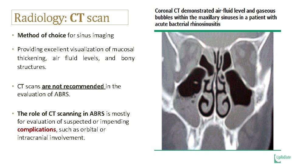 Radiology: CT scan • Method of choice for sinus imaging • Providing excellent visualization