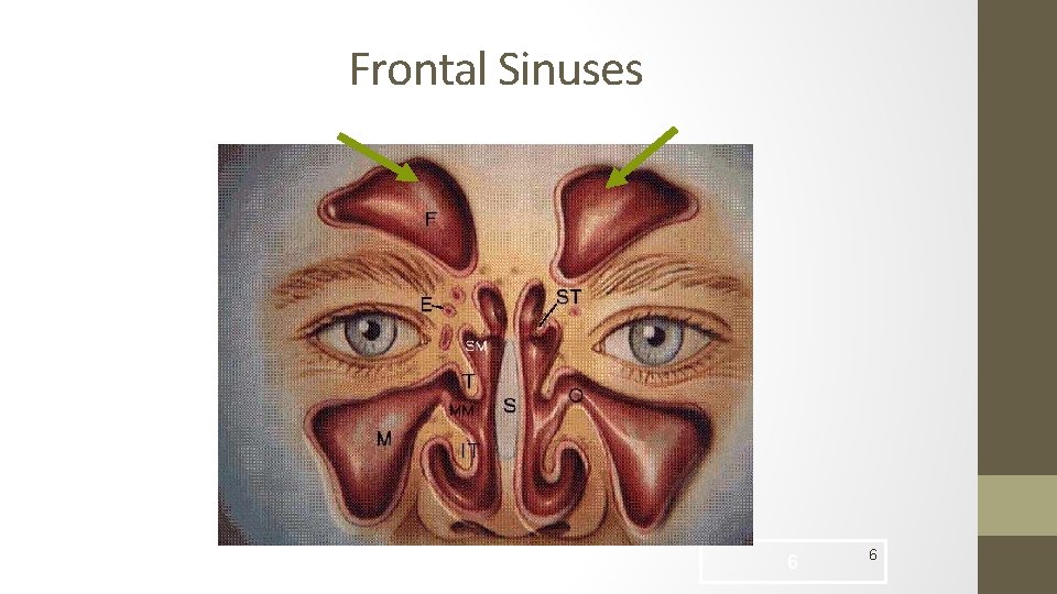 Frontal Sinuses 6 6 