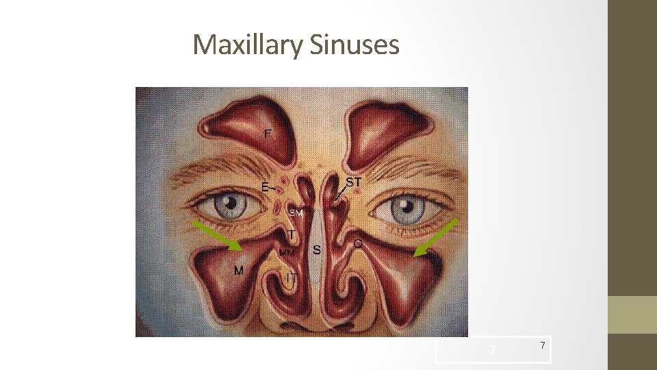 Maxillary Sinuses 7 7 
