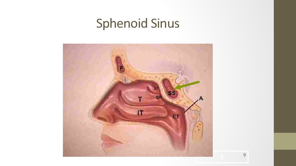 Sphenoid Sinus 9 9 