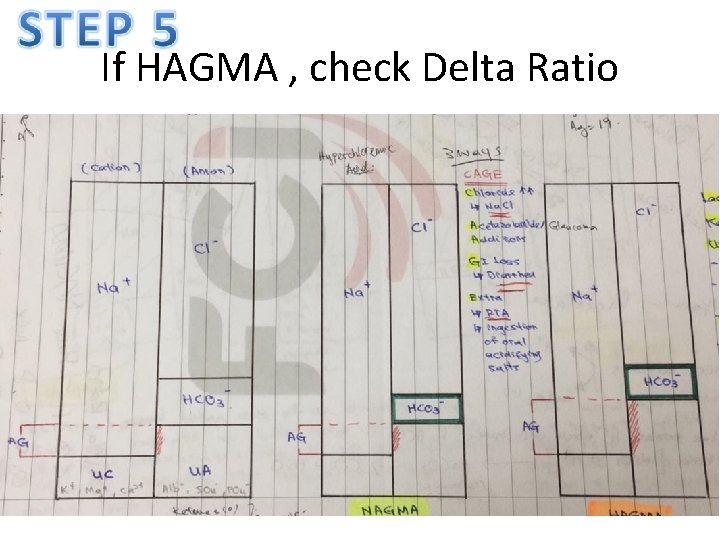If HAGMA , check Delta Ratio 