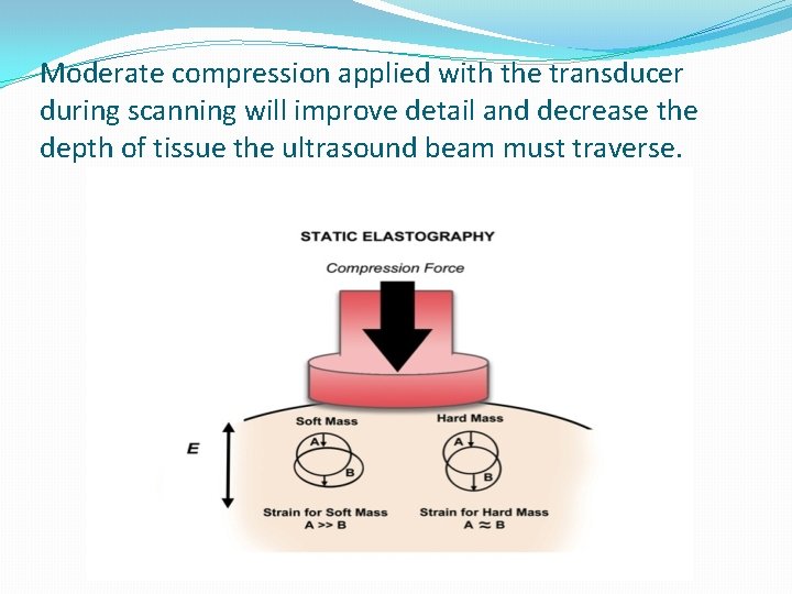 Moderate compression applied with the transducer during scanning will improve detail and decrease the