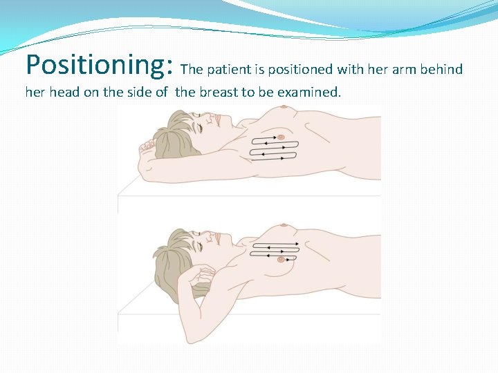 Positioning: The patient is positioned with her arm behind her head on the side