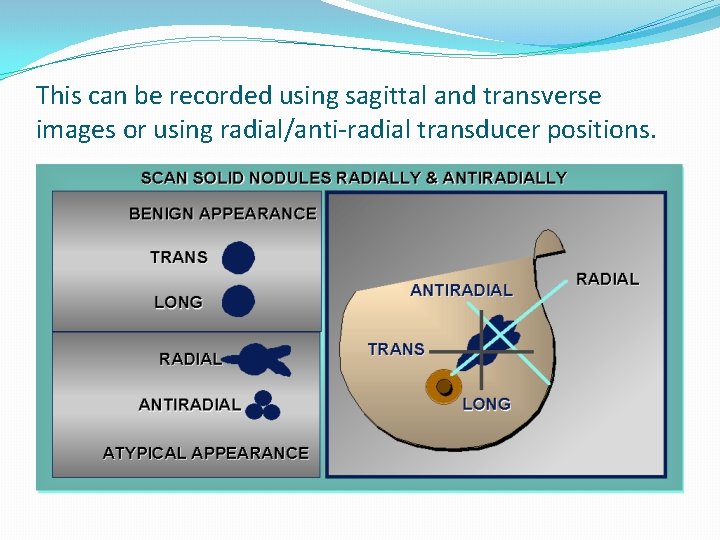 This can be recorded using sagittal and transverse images or using radial/anti-radial transducer positions.