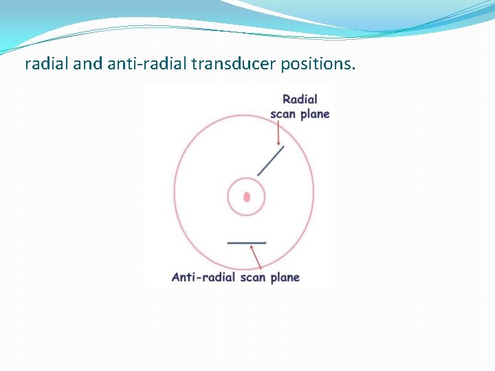 radial and anti-radial transducer positions. 