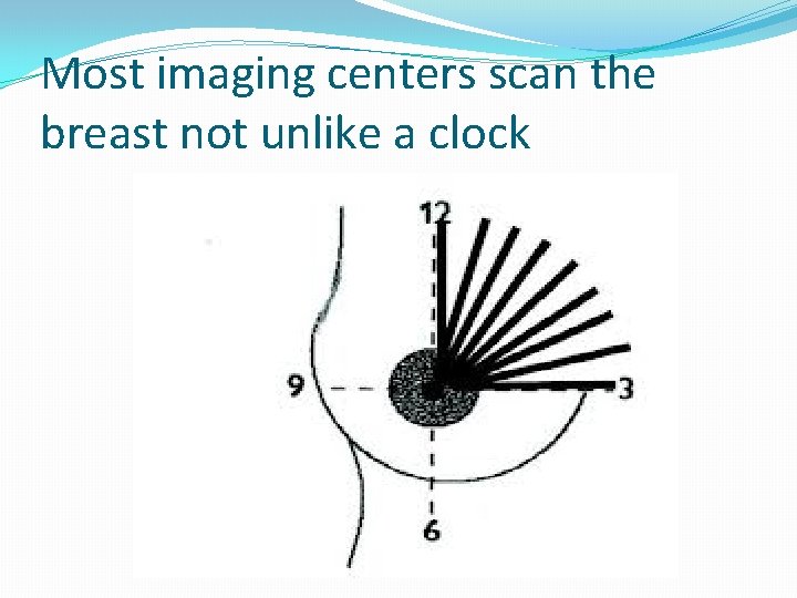 Most imaging centers scan the breast not unlike a clock 