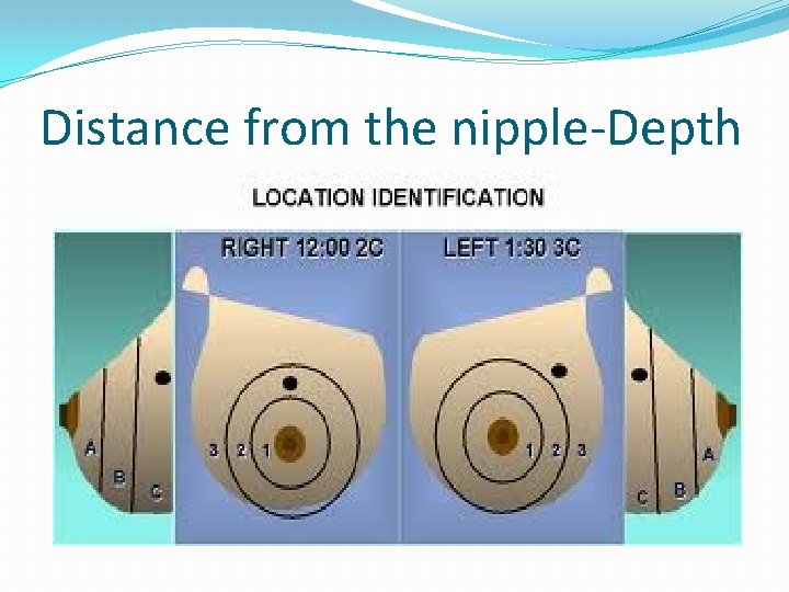Distance from the nipple-Depth 