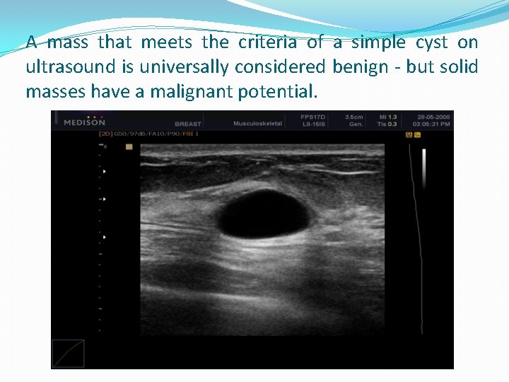 A mass that meets the criteria of a simple cyst on ultrasound is universally