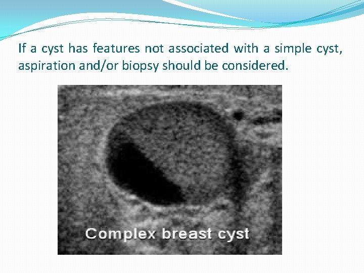 If a cyst has features not associated with a simple cyst, aspiration and/or biopsy