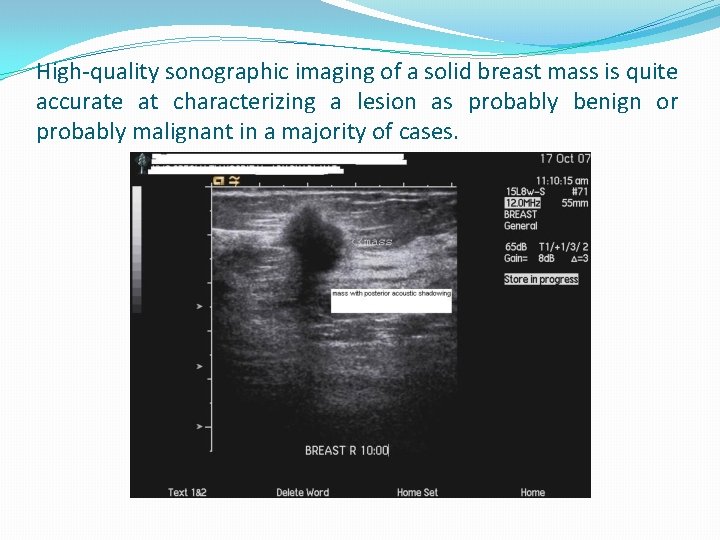 High-quality sonographic imaging of a solid breast mass is quite accurate at characterizing a