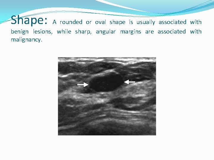 Shape: A rounded or oval shape is usually associated with benign lesions, while sharp,
