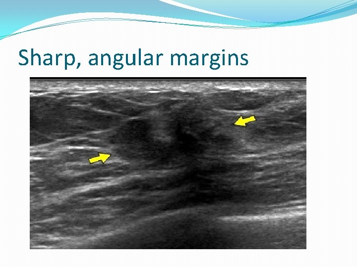 Sharp, angular margins 